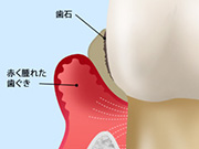 第3段階